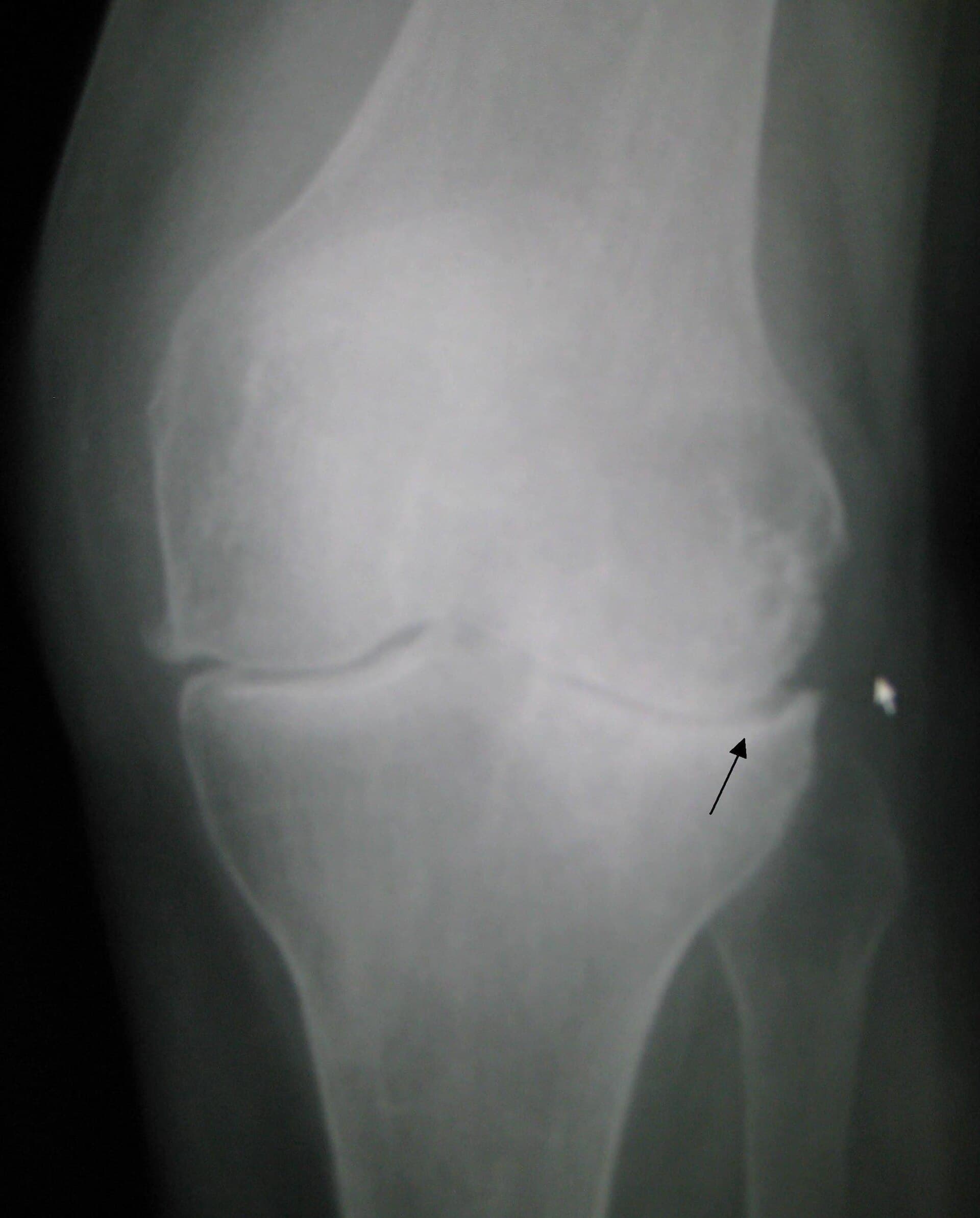 Featured article image