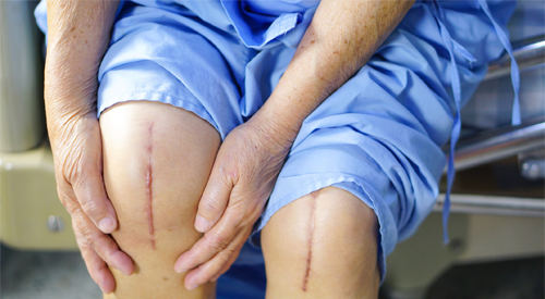 Best Joint Replacement Surgeon in Jaipur