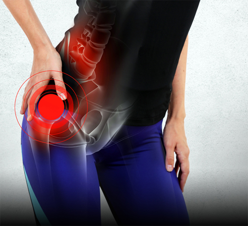 Hip Replacement in Jaipur