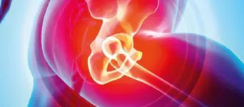 Revision Hip Replacement