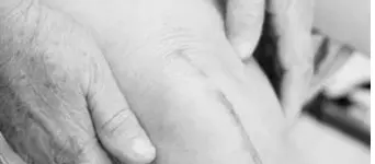 Total Knee Replacement